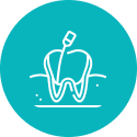 Root Canals in centerville ohio