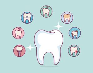 common dental problems