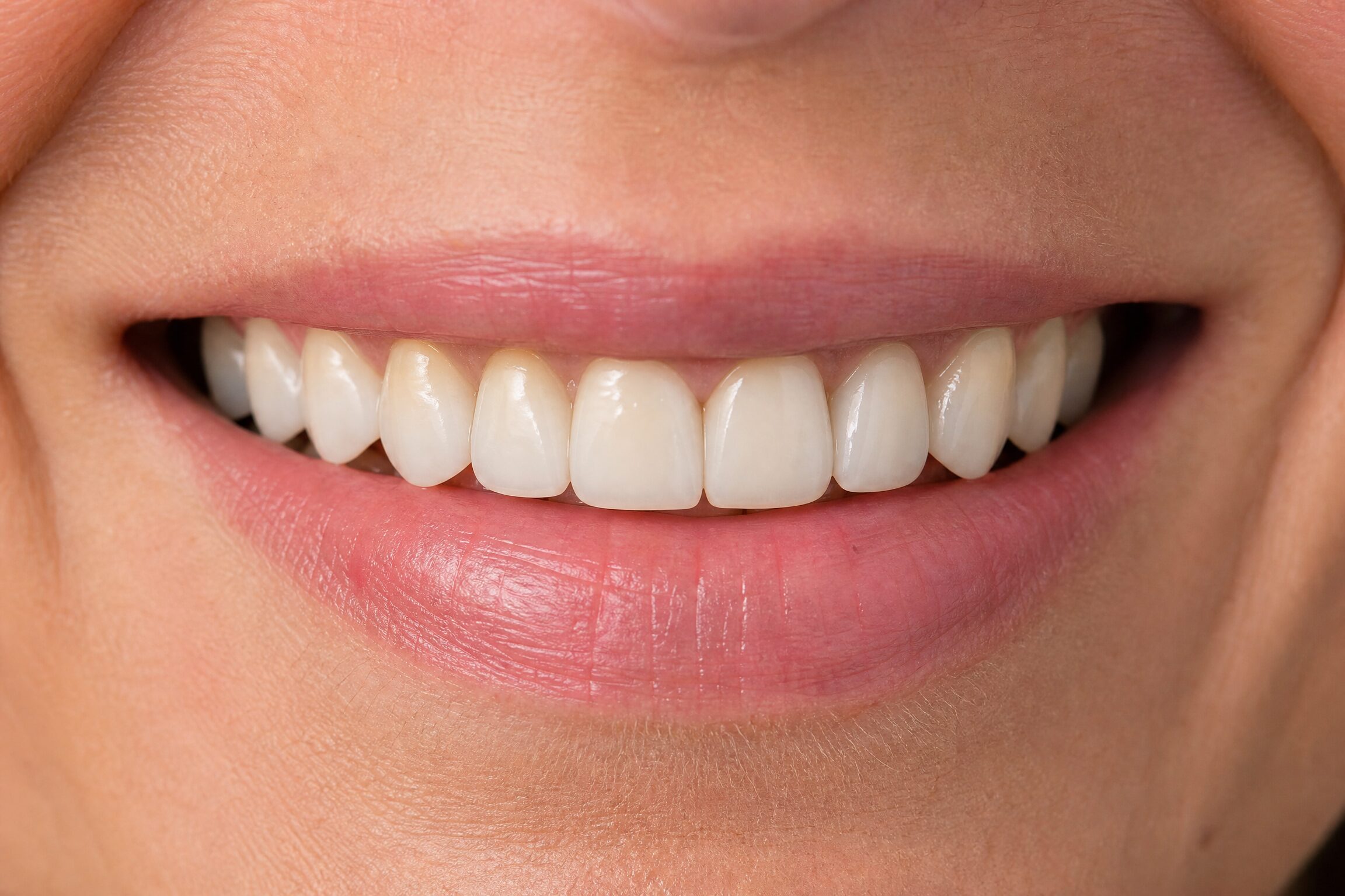 Natural-looking porcelain dental crown result at Centerville Dental Center